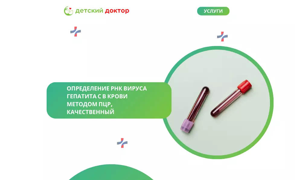 Определение РНК вируса гепатита С в крови методом ПЦР, количественный